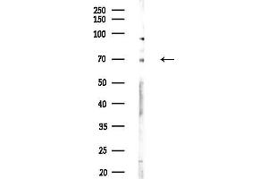 Western blot analysis of lysates from COLO205 cells(heat-shock,45 min treatment), using CBF Antibody at 1/1000 dilution.
