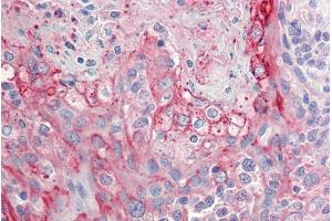 ABIN571241 (5µg/ml) staining of paraffin embedded Human Tonsil.