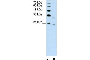 WB Suggested Anti-DNASE2B Antibody Titration:  1. (DNASE2B anticorps  (C-Term))
