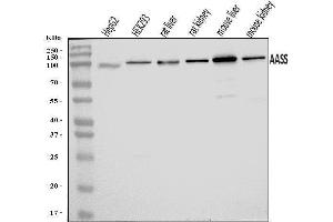 Western blot analysis of AASS using anti-AASS antibody (ABIN7601519).