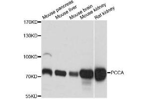Western blot analysis of extracts of various cell lines, using PCCA antibody. (PCCA anticorps  (AA 449-728))