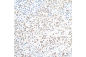 Immunohistochemistry (IHC) image for anti-PHD Finger Protein 8 (PHF8) (AA 650-700) antibody (ABIN7454781) (PHF8 anticorps  (AA 650-700))