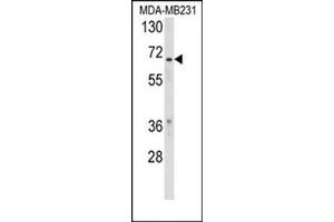Western blot analysis of RXRB Antibody (Center) Cat. (Retinoid X Receptor beta anticorps  (Middle Region))