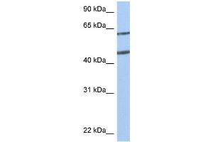 WB Suggested Anti-NTN4 Antibody Titration:  0. (Netrin 4 anticorps  (N-Term))