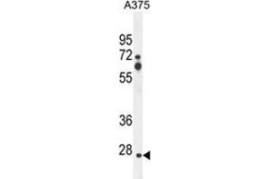 ZCCHC17 Antibody (Center) western blot analysis in A375 cell line lysates (35 µg/lane). (ZCCHC17 anticorps  (Middle Region))