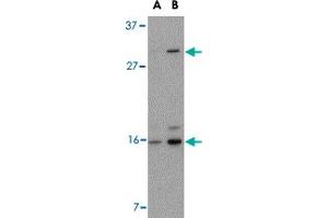 Western blot analysis of DRAM in 293 cell lysate with DRAM polyclonal antibody  at (A) 0. (DRAM anticorps  (C-Term))