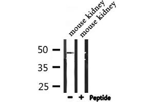 Western blot analysis of extracts from mouse kidney, using IP6K2 Antibody. (IP6K2 anticorps  (Internal Region))