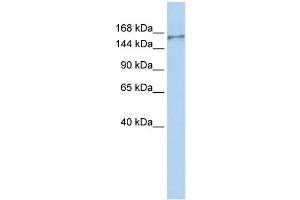 WB Suggested Anti-NBEAL1 Antibody Titration:  0. (NBEAL1 anticorps  (N-Term))