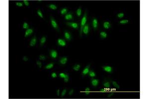 Immunofluorescence of monoclonal antibody to NR0B1 on HeLa cell. (NR0B1 anticorps  (AA 361-470))