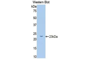 Western blot analysis of the recombinant protein. (GCKR anticorps  (AA 90-286))