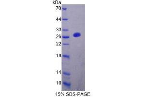 SDS-PAGE analysis of Rat FBLN7 Protein. (FBLN7 Protéine)