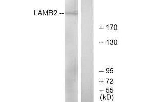 Western blot analysis of extracts from RAW264. (LAMB2 anticorps)