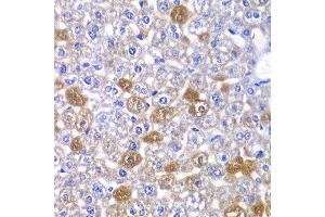 Immunohistochemistry of paraffin-embedded mouse liver using MYO1C antibody at dilution of 1:100 (x40 lens). (Myosin IC anticorps)