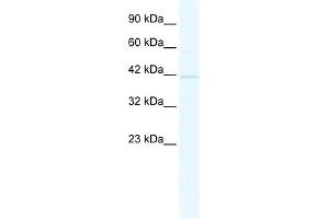WB Suggested Anti-BTBD14B Antibody Titration:  2.