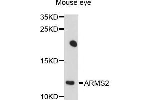 Western blot analysis of extracts of mouse eye cells, using ARMS2 antibody. (ARMS2 anticorps)