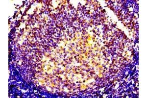 Immunohistochemistry of paraffin-embedded human lymph node tissue using ABIN7146111 at dilution of 1:100 (CXCR5 anticorps  (AA 1-55))