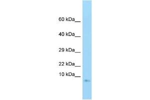 WB Suggested Anti-GNG3 Antibody Titration: 1. (GNG3 anticorps  (Middle Region))