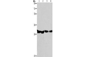 Western Blotting (WB) image for anti-2,4-Dienoyl CoA Reductase 1, Mitochondrial (DECR1) antibody (ABIN2432931)