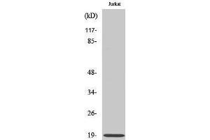 Western Blotting (WB) image for anti-Stathmin 1 (STMN1) (Ser729) antibody (ABIN3186213) (Stathmin 1 anticorps  (Ser729))