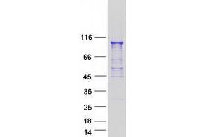 Validation with Western Blot