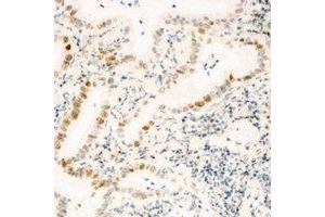 Immunohistochemical analysis of ZNF596 staining in human kidney formalin fixed paraffin embedded tissue section. (ZNF596 anticorps)