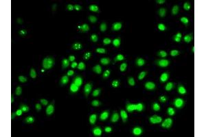 Immunofluorescence analysis of HeLa cells using TP53 antibody (ABIN5999084). (p53 anticorps)