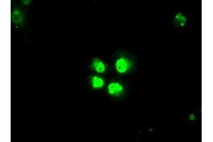 Anti-SATB1 mouse monoclonal antibody (ABIN2452628) immunofluorescent staining of COS7 cells transiently transfected by pCMV6-ENTRY SATB1 (RC200421). (SATB1 anticorps)