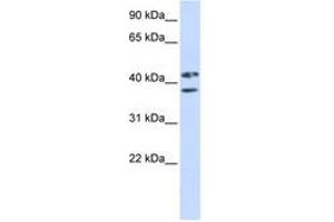 Image no. 1 for anti-Zinc Finger Protein 265 (Zranb2) (AA 144-193) antibody (ABIN6743051) (ZNF265 anticorps  (AA 144-193))