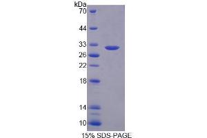 SDS-PAGE analysis of Human PLA2G3 Protein. (PLA2G3 Protéine)