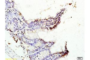 anti-CDX2+3 (AA 151-260) antibody