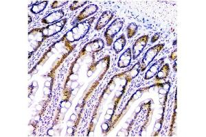 IHC analysis of HAUSP/USP7 using anti-HAUSP/USP7 antibody (ABIN6719603). (USP7 anticorps  (AA 258-483))
