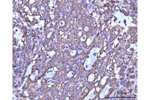 anti-Ribosomal Protein S14 (RPS14) (AA 1-151) antibody