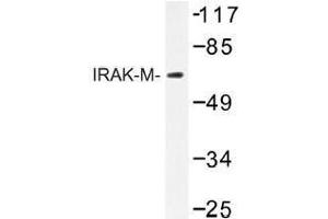 Image no. 1 for anti-Interleukin-1 Receptor-Associated Kinase 3 (IRAK3) antibody (ABIN317722) (IRAK3 anticorps)