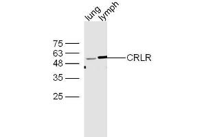 anti-Crlr/Cgrpr1 (AA 281-380) antibody