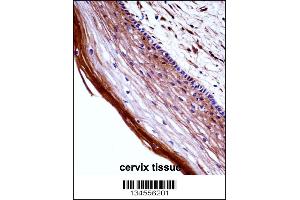 PGF Antibody immunohistochemistry analysis in formalin fixed and paraffin embedded human cervix tissue followed by peroxidase conjugation of the secondary antibody and DAB staining.