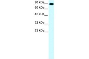 Western Blotting (WB) image for anti-Zinc Finger Protein 828 (ZNF828) antibody (ABIN2460309) (ZNF828 anticorps)