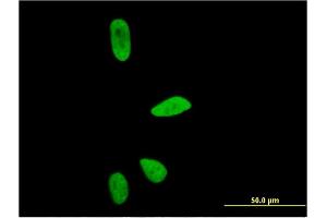 Immunofluorescence of monoclonal antibody to CD3EAP on HeLa cell. (CD3EAP anticorps  (AA 2-110))