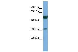 Host:  Rabbit  Target Name:  FAM3B  Sample Type:  PANC1 Whole cell lysates  Antibody Dilution:  1. (FAM3B anticorps  (Middle Region))