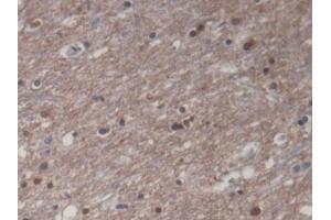 DAB staining on IHC-P; Samples: Human Cerebrum Tissue