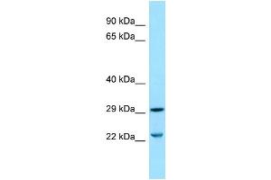 WB Suggested Anti-SLC25A10 Antibody Titration: 1.