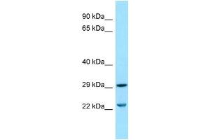 WB Suggested Anti-SLC25A10 Antibody Titration: 1. (SLC25A10 anticorps  (Middle Region))
