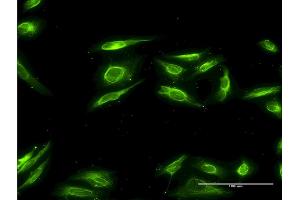 Immunofluorescence of monoclonal antibody to AKR1B10 on HeLa cell. (AKR1B10 anticorps  (AA 76-143))