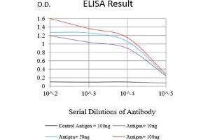 Black line: Control Antigen (100 ng),Purple line: Antigen (10 ng), Blue line: Antigen (50 ng), Red line:Antigen (100 ng) (CD56 anticorps)