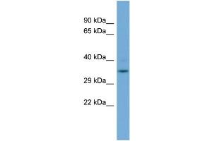 WB Suggested Anti-GLOD4  Antibody Titration: 0. (GLOD4 anticorps  (N-Term))
