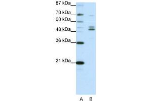 WB Suggested Anti-FOXA2 Antibody Titration:  0. (FOXA2 anticorps  (C-Term))