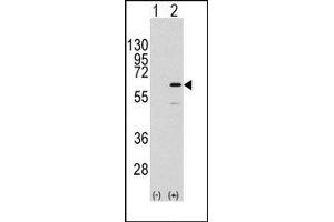 Image no. 1 for anti-ELK1, Member of ETS Oncogene Family (ELK1) (Ser383) antibody (ABIN358791) (ELK1 anticorps  (Ser383))