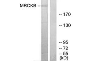 Western Blotting (WB) image for anti-CDC42 Binding Protein Kinase beta (DMPK-Like) (CDC42BPB) (AA 1641-1690) antibody (ABIN2879167) (CDC42BPB anticorps  (AA 1641-1690))