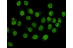Immunocytochemistry staining of HeLa cells fixed with 4 % Paraformaldehyde and using anti-SMC1A mouse mAb(dilution 1:100).