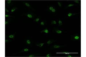 Immunofluorescence of monoclonal antibody to PLRG1 on HeLa cell. (PLRG1 anticorps  (AA 101-198))