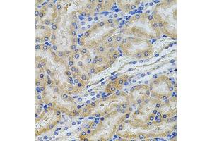 Immunohistochemistry of paraffin-embedded rat kidney using PCSK9 antibody. (PCSK9 anticorps)